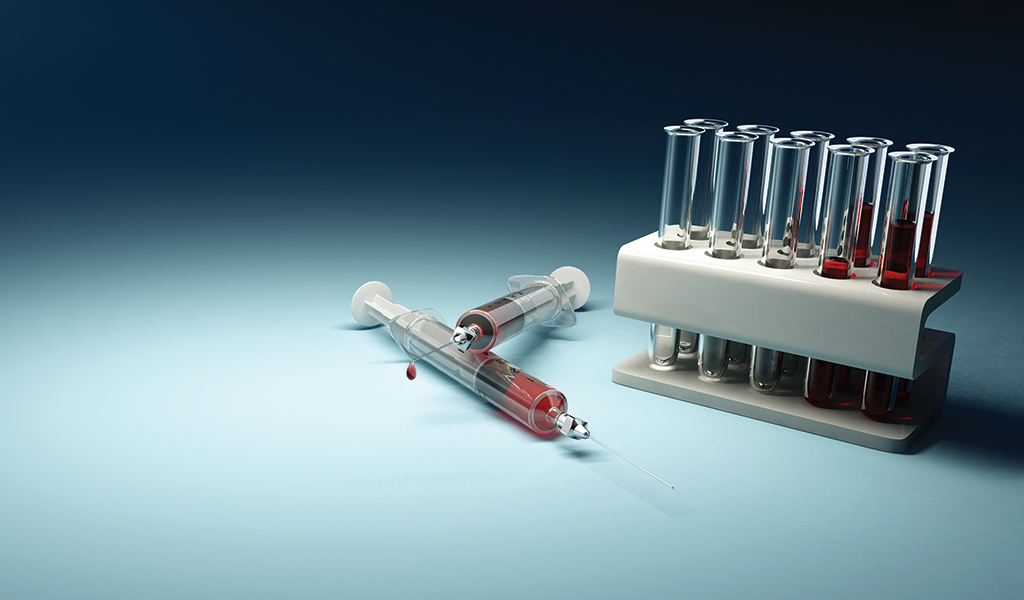 New blood test for viral infections shows promise Nursing Times