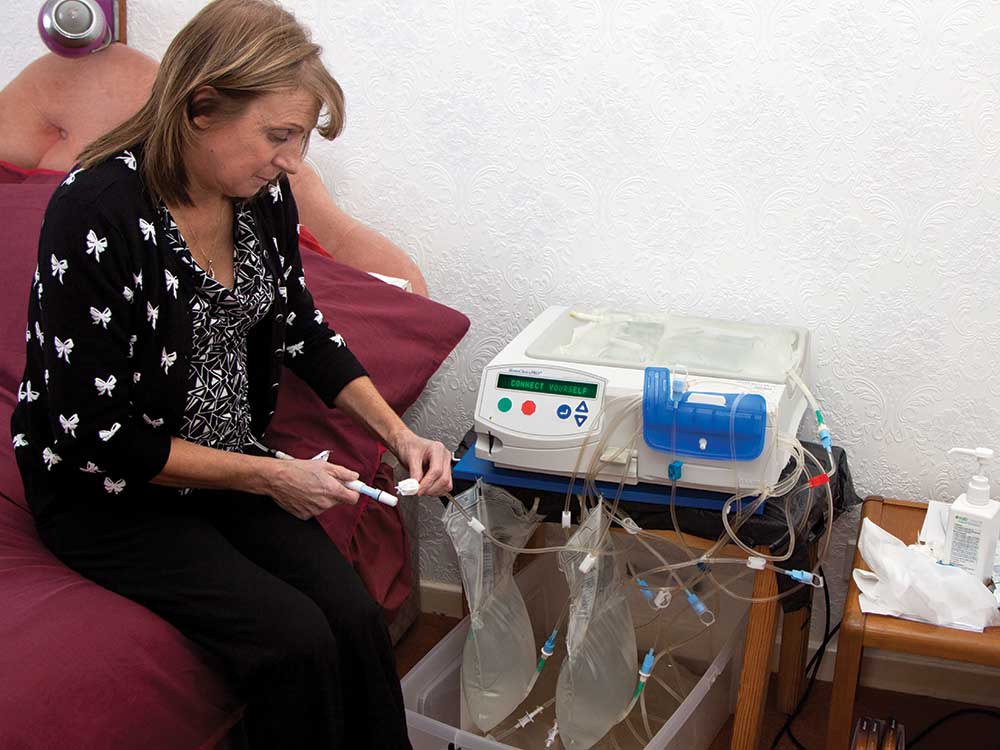 Peritoneal dialysis 2 peritoneal dialysis a guide for nonrenal