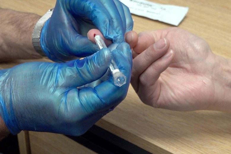 Rapid HIV test rolled out in Glasgow amid outbreak among drug users