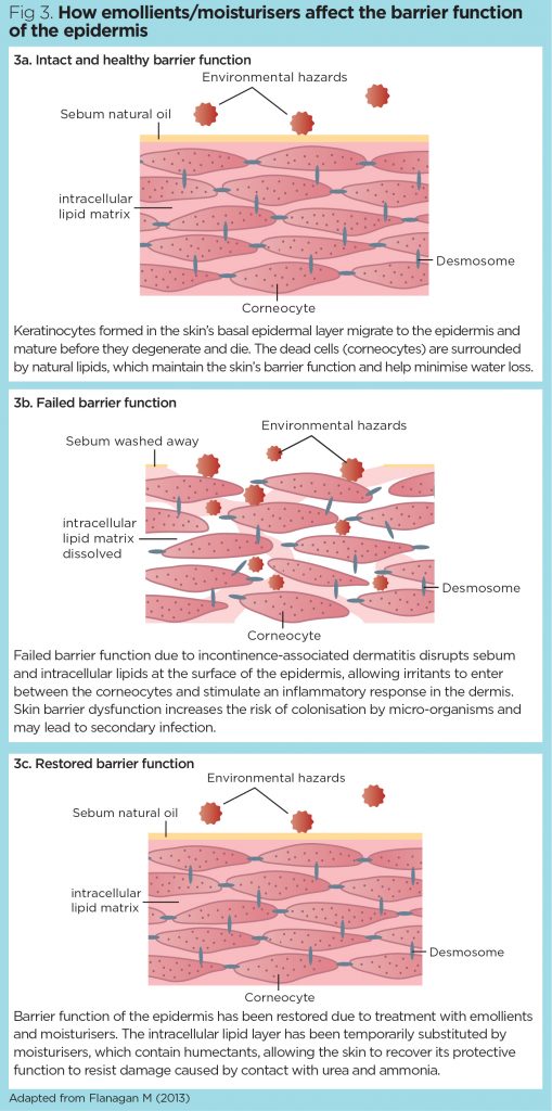 Incontinenceassociated dermatitis 2 assessment, diagnosis and management Nursing Times
