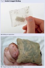 the-principles-of-maggot-therapy-and-its-role-in-contemporary-wound