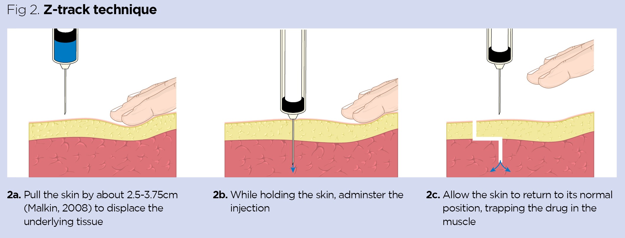 Injection Technique 1 Administering Drugs Via The Intramuscular Route 