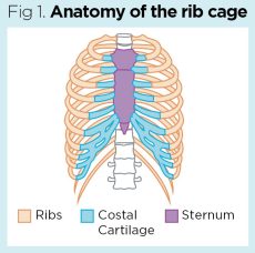 Trauma nursing 2: management of patients with rib fractures | Nursing Times