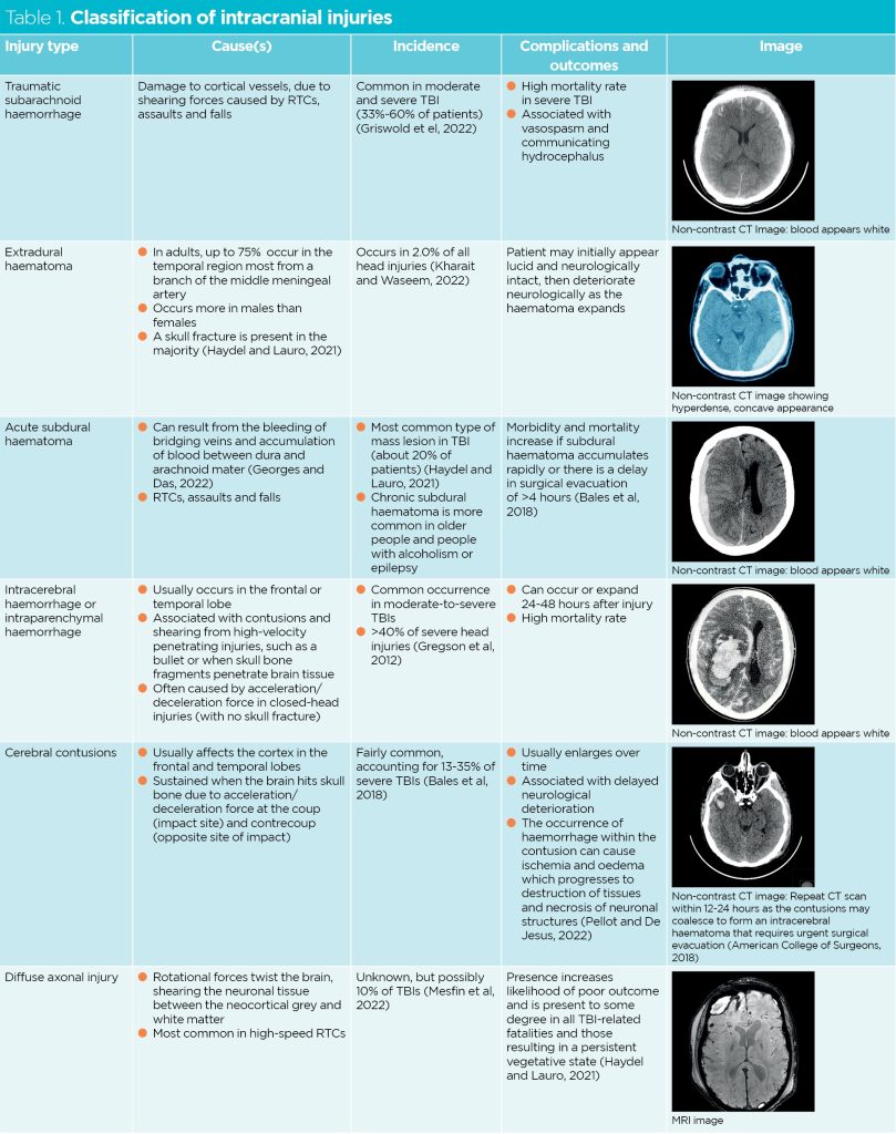 Trauma Nursing 3 Assessing And Managing Head Injury Nursing Times