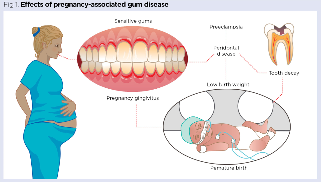 Pregnancy 3: effects on the musculoskeletal system and skin | Nursing Times