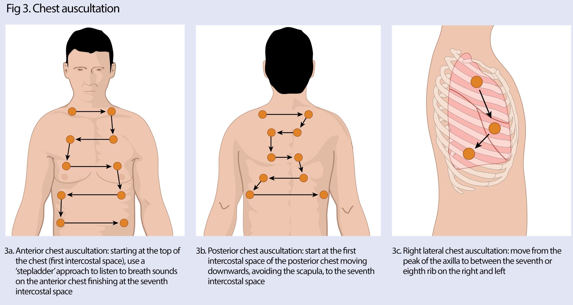 How to carry out a respiratory assessment in advanced practice ...