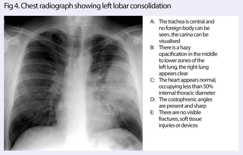 How To Interpret Chest Radiographs X rays A Systematic Approach How To Interpret Chest Radiographs X rays A Systematic Approach