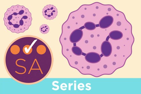 Understanding the causes, symptoms and treatments of anaemias | Nursing  Times