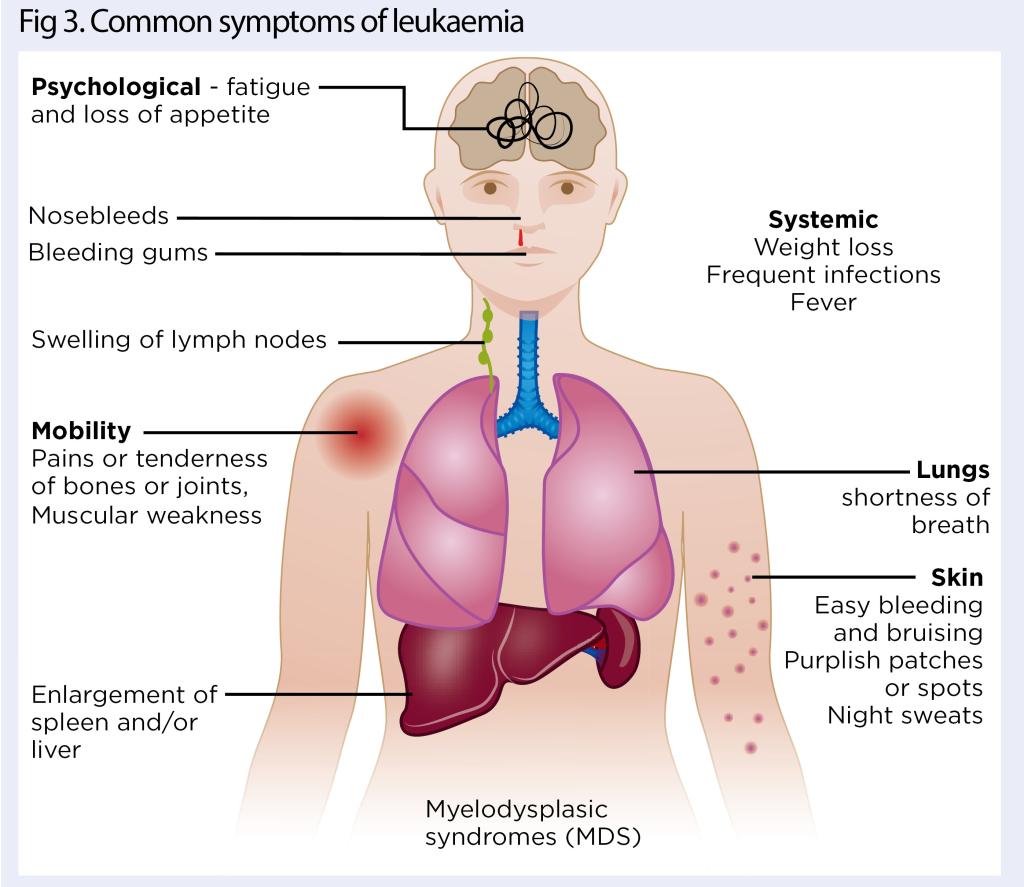 Understanding leukaemia: risk factors, symptoms and treatment | Nursing