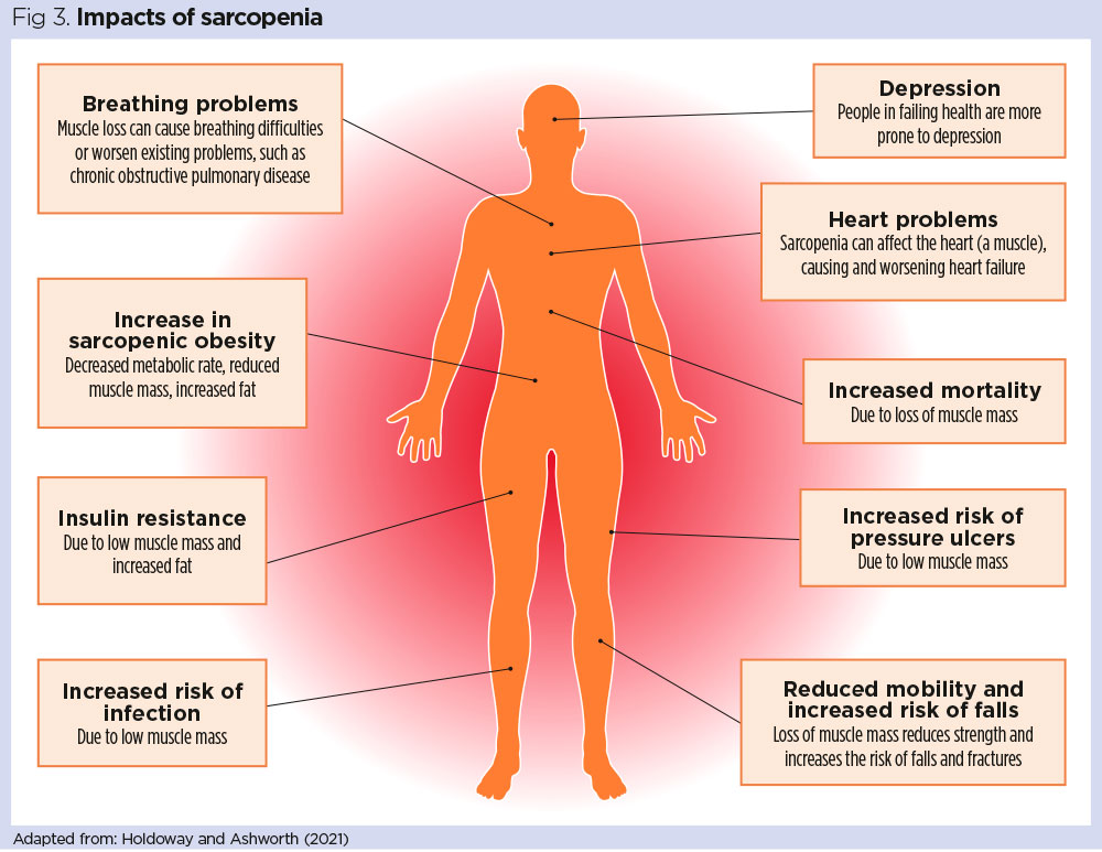 Fig-3-Impacts-of-sarcopenia-.jpg